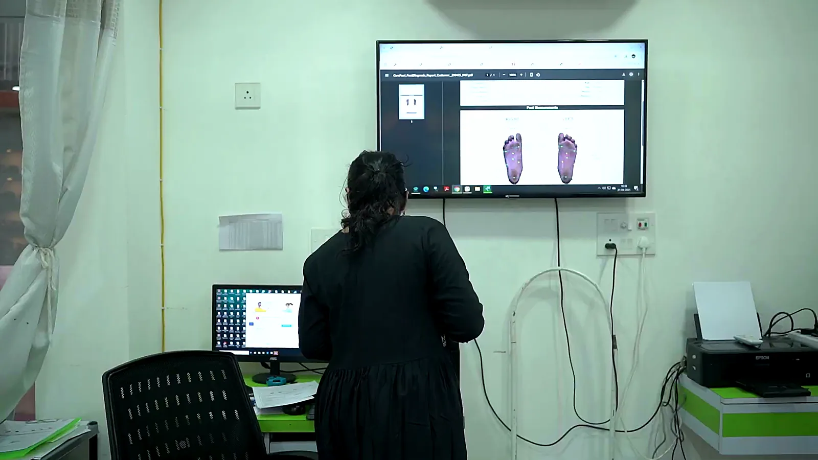 Foot scan reviewed on screen at CuraFoot